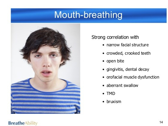 dental-sleep-breathing-retraining-spreecast-tess-graham-raphael-center-oct-2014-14-638